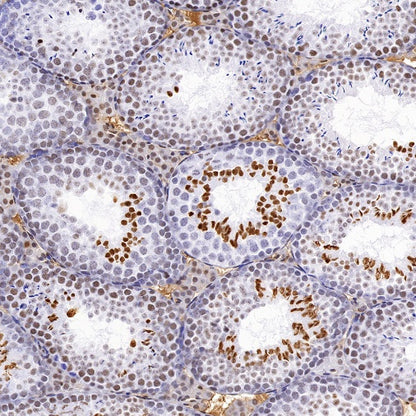 Histone H4 (acetyl K5) Recombinant Rabbit mAb (S-1464-112)