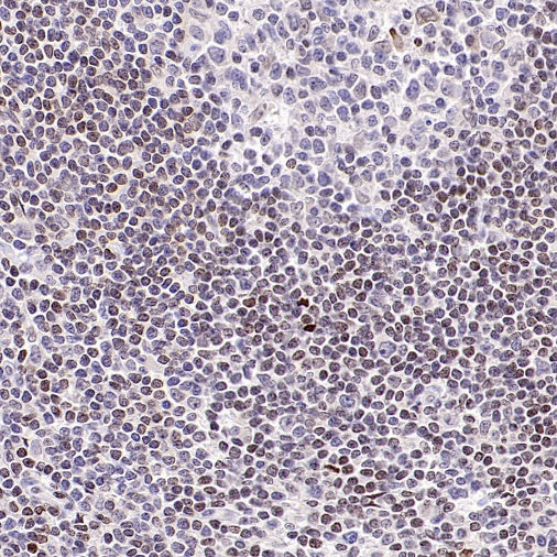 Histone H3 (tri methyl K27) Recombinant Rabbit mAb (S-4098)