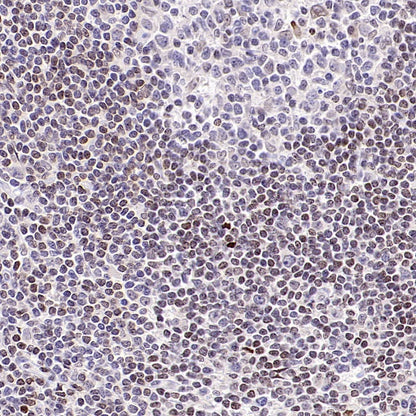 Histone H3 (tri methyl K27) Recombinant Rabbit mAb (S-4098)