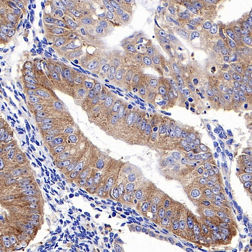 RPS3A Rabbit polyclonal antibody