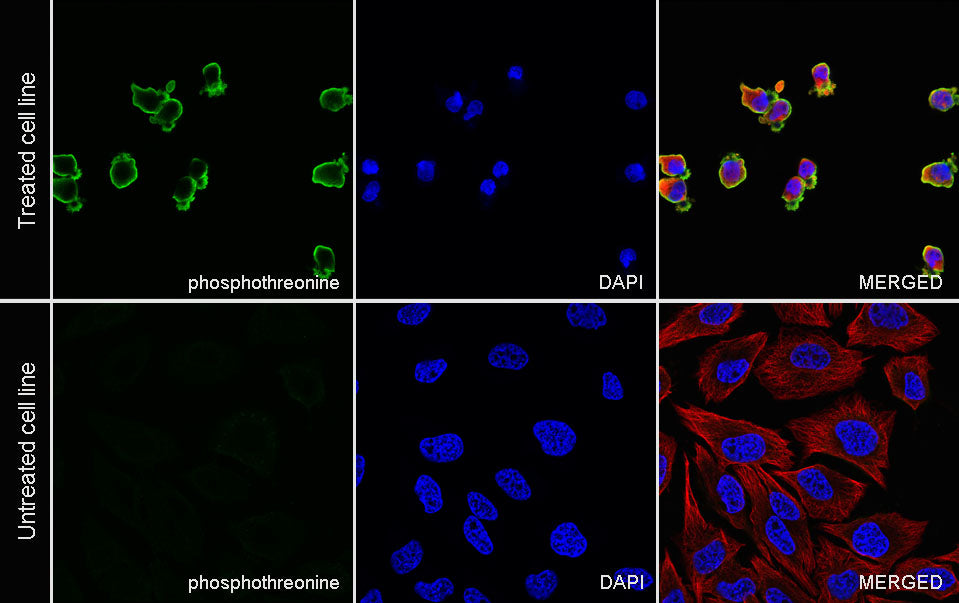 Phosphothreonine Recombinant Rabbit mAb (S-4181-29)