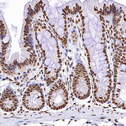 Histone H3 (tri methyl K4) Recombinant Rabbit mAb (S-1602-21)