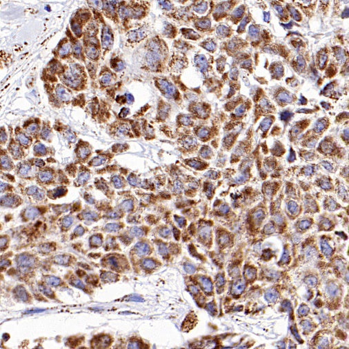 DLST Recombinant Rabbit mAb (S-2283-10)