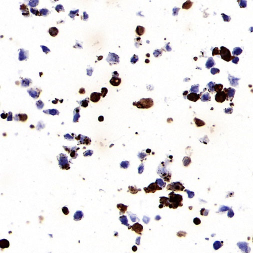 KRAS (mutated GQ60GK) + (mutated Q61K) Recombinant Rabbit mAb (S-604-4)
