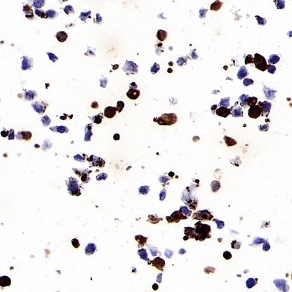 KRAS (mutated GQ60GK) + (mutated Q61K) Recombinant Rabbit mAb (S-604-4)