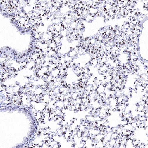 Histone H3 (di methyl K14) Recombinant Rabbit mAb (S-R414)