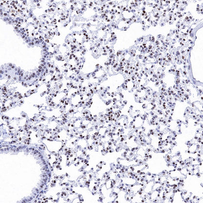 Histone H3 (di methyl K14) Recombinant Rabbit mAb (S-R414)