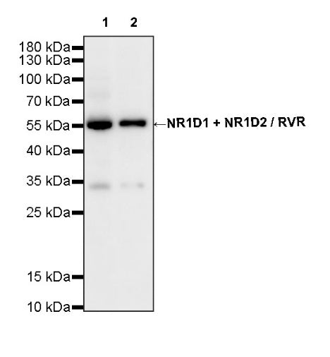 NR1D1 + NR1D2 / RVR Recombinant Rabbit mAb (S-5962)