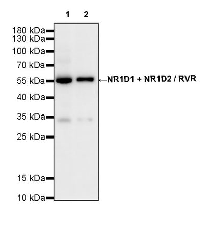 NR1D1 + NR1D2 / RVR Recombinant Rabbit mAb (S-5962)