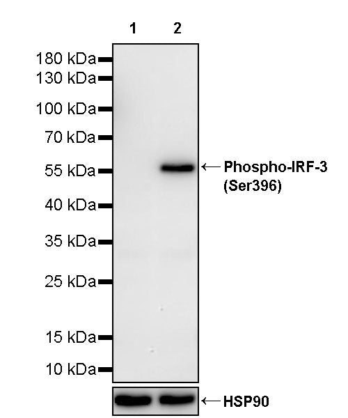 Phospho-IRF3 (Ser396) Recombinant Rabbit mAb (S-3598)