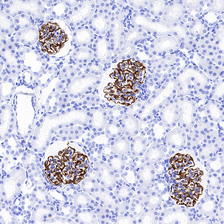 Nestin Recombinant Rabbit mAb (S-3890-112)