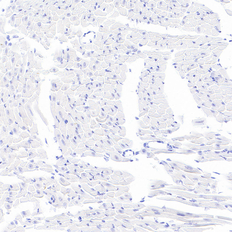 Stat4 Recombinant Rabbit mAb (S-4916-70)