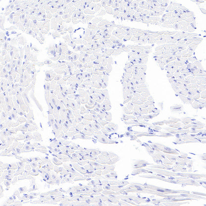Stat4 Recombinant Rabbit mAb (S-4916-70)