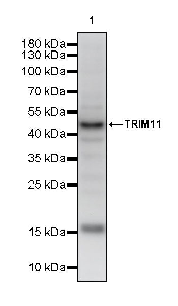 TRIM11 Recombinant Rabbit mAb (S-2913-79)