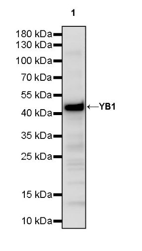 YB1 Recombinant Rabbit mAb (S-1748-144)