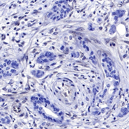 SMAD4 Recombinant Rabbit mAb (SDT-168-62)