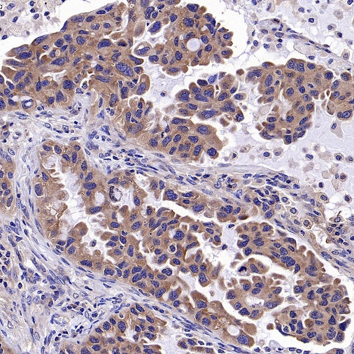 TSG101 Recombinant Rabbit mAb (S-1868-76)