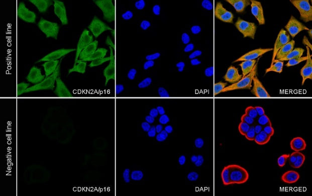 CDKN2A/p16 INK4A Recombinant Mouse mAb (SDT-4677)