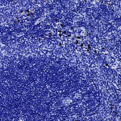 MMP-8 Recombinant Rabbit mAb (S-5674)