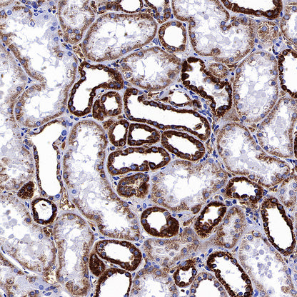 NDUFB8 Recombinant Rabbit mAb (S-4770-29)