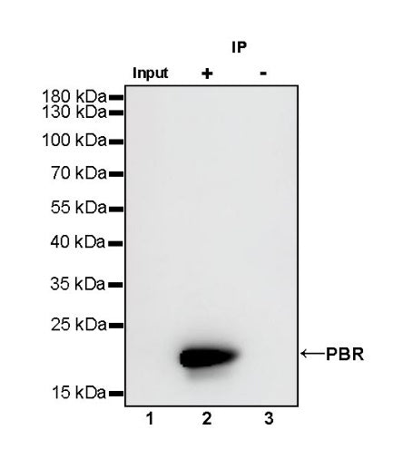 PBR/TSPO Recombinant Rabbit mAb (S-607-19)