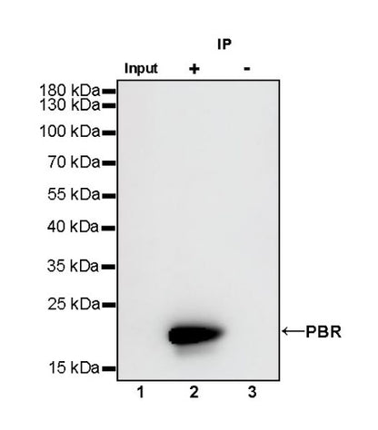 PBR/TSPO Recombinant Rabbit mAb (S-607-19)
