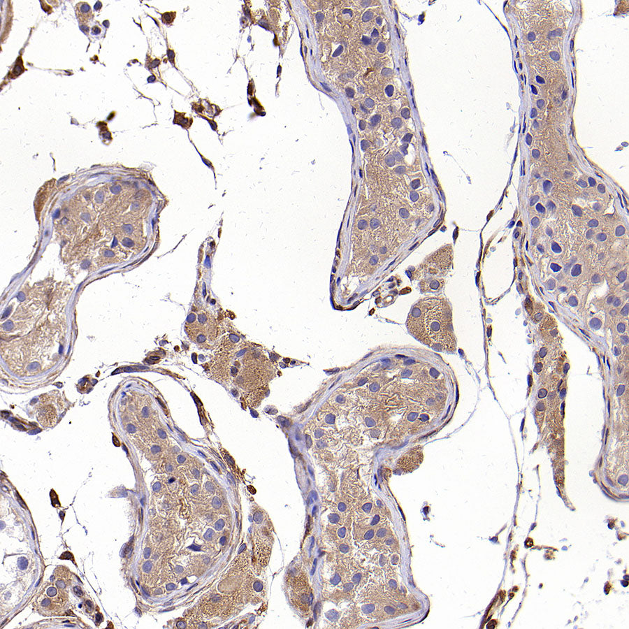 Calpain 1 Recombinant Rabbit mAb (S-3797-41)