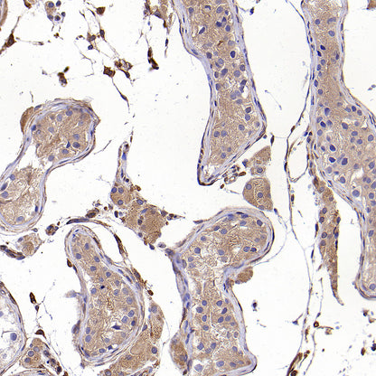 Calpain 1 Recombinant Rabbit mAb (S-3797-41)