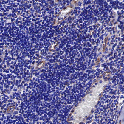 sFlt-1/VEGF Receptor 1 Recombinant Rabbit mAb (SDT-233-29)