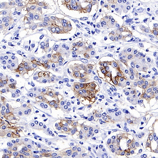 CD44v6 Recombinant Rabbit mAb (S-944-13)