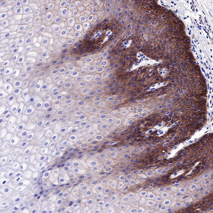 EGFR Recombinant Rabbit mAb (SDT-R110)