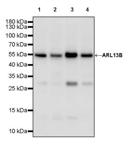 ARL13B Recombinant Rabbit mAb (S-2113-11)