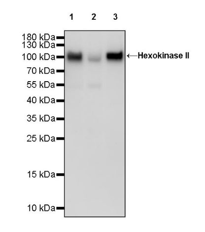 Hexokinase II Rabbit Polyclonal Antibody
