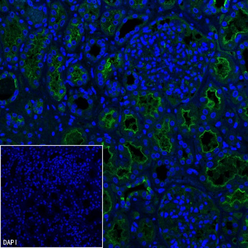 Angiotensin Converting Enzyme 1 Recombinant Rabbit mAb (SDT-2662-122)