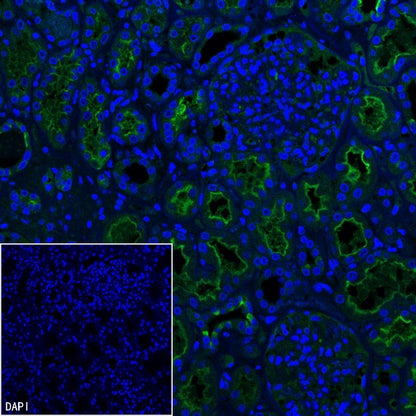 Angiotensin Converting Enzyme 1 Recombinant Rabbit mAb (SDT-2662-122)