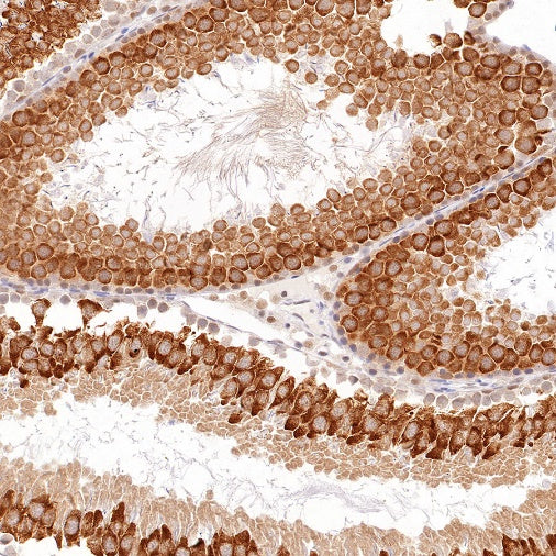 RUVBL1 Recombinant Rabbit mAb (S-1600-38)