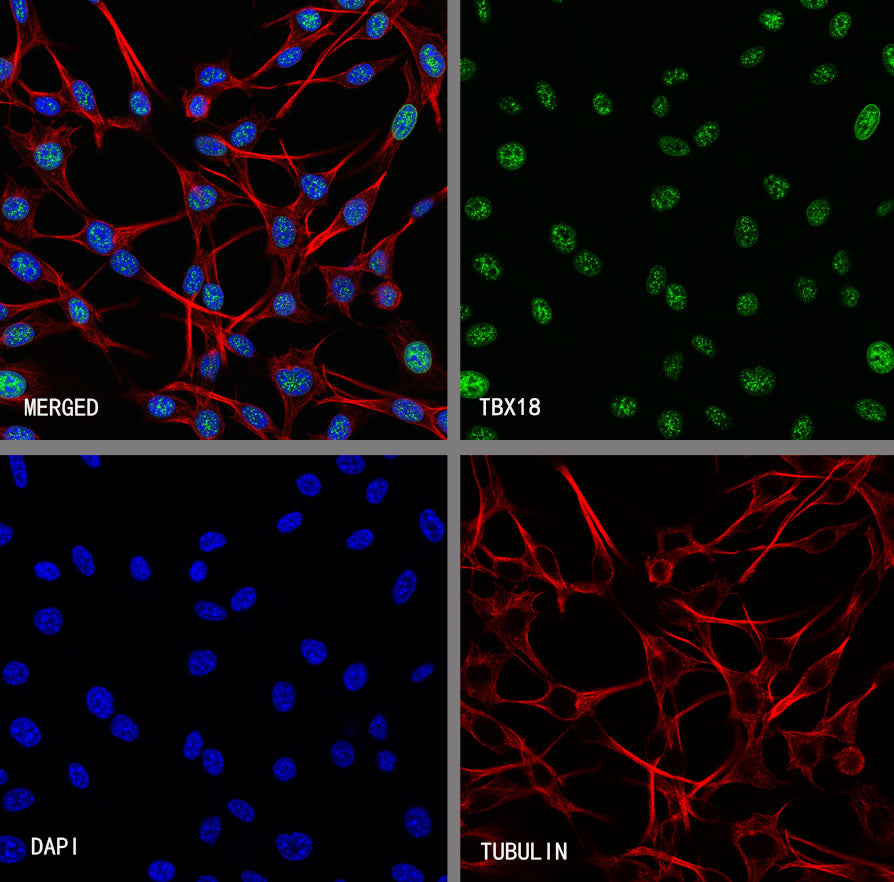TBX18 Recombinant Rabbit mAb (S-4619-17)