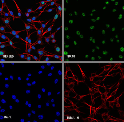 TBX18 Recombinant Rabbit mAb (S-4619-17)