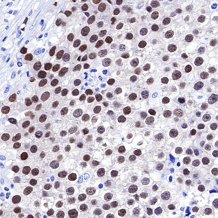 OCT3/4 Recombinant Rabbit mAb (SDT-165-76)