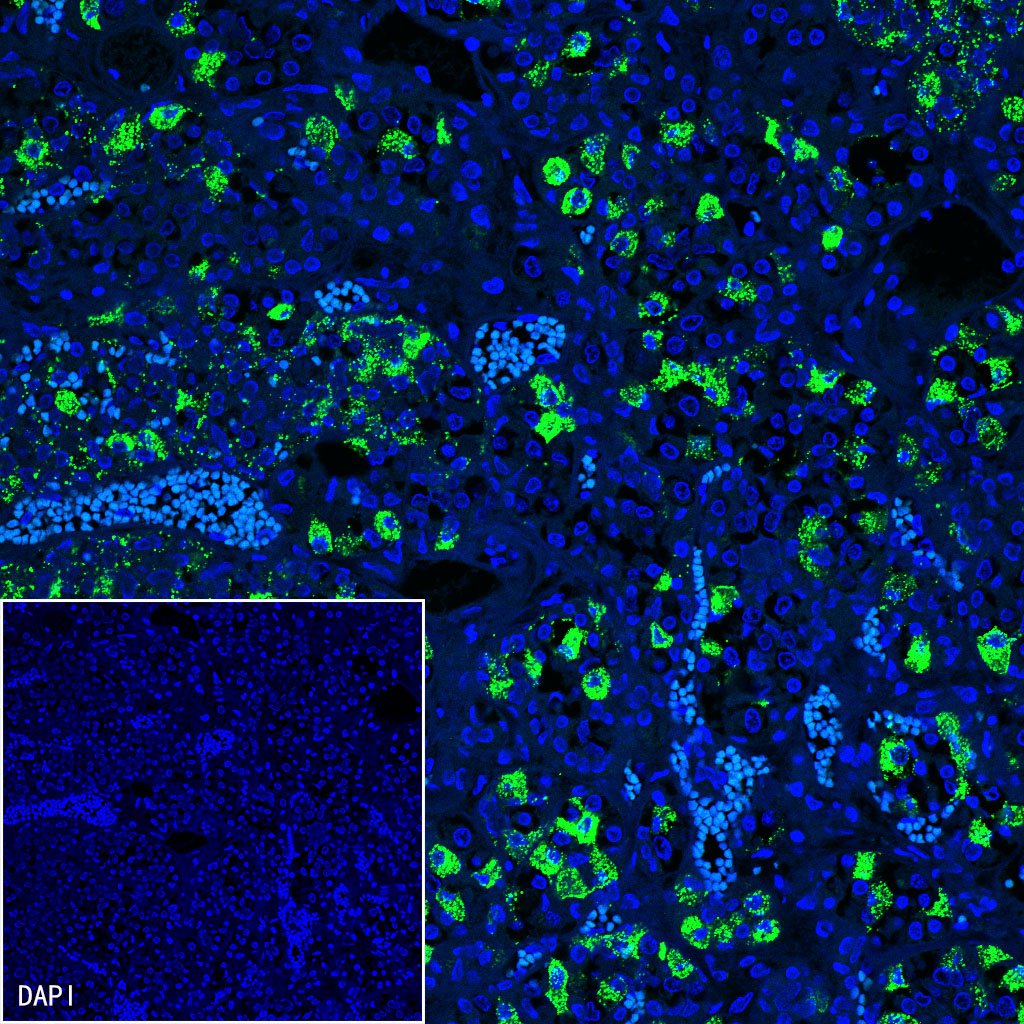 Luteinizing Hormone Beta Recombinant Rabbit mAb (SDT-545-2)