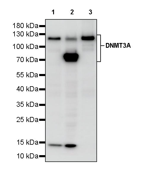DNMT3A Recombinant Rabbit mAb (S-4120-54)