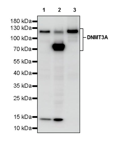 DNMT3A Recombinant Rabbit mAb (S-4120-54)