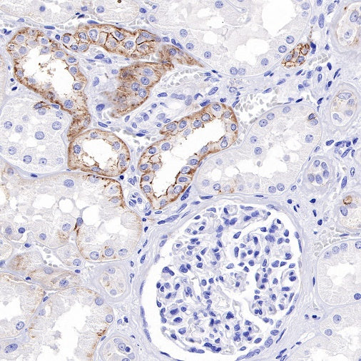 Claudin 4 Recombinant Rabbit mAb (SDT-814-53)