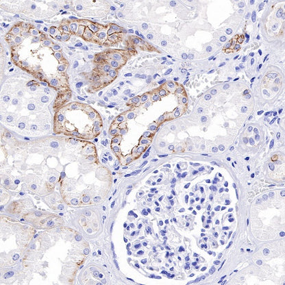 Claudin 4 Recombinant Rabbit mAb (SDT-814-53)