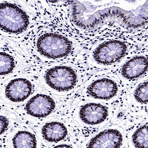 SREBP2 Recombinant Rabbit mAb (S-2701-1)