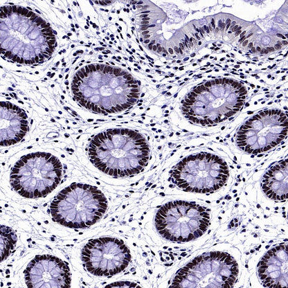SREBP2 Recombinant Rabbit mAb (S-2701-1)