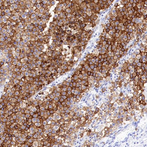 ALPP/ALPPL2 Recombinant Rabbit mAb (S-2089-36)