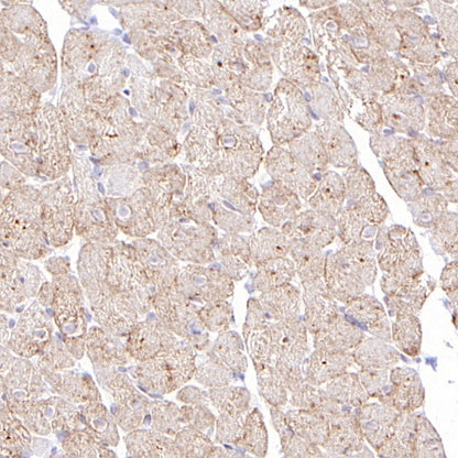 GLUT4 Recombinant Rabbit mAb (S-584-50)