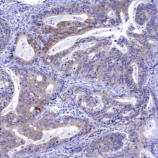 Cortactin Recombinant Rabbit mAb (S-1303-10)