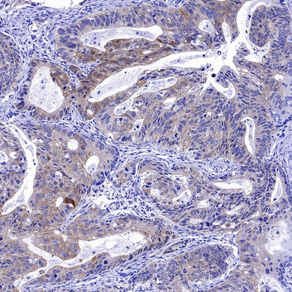 Cortactin Recombinant Rabbit mAb (S-1303-10)